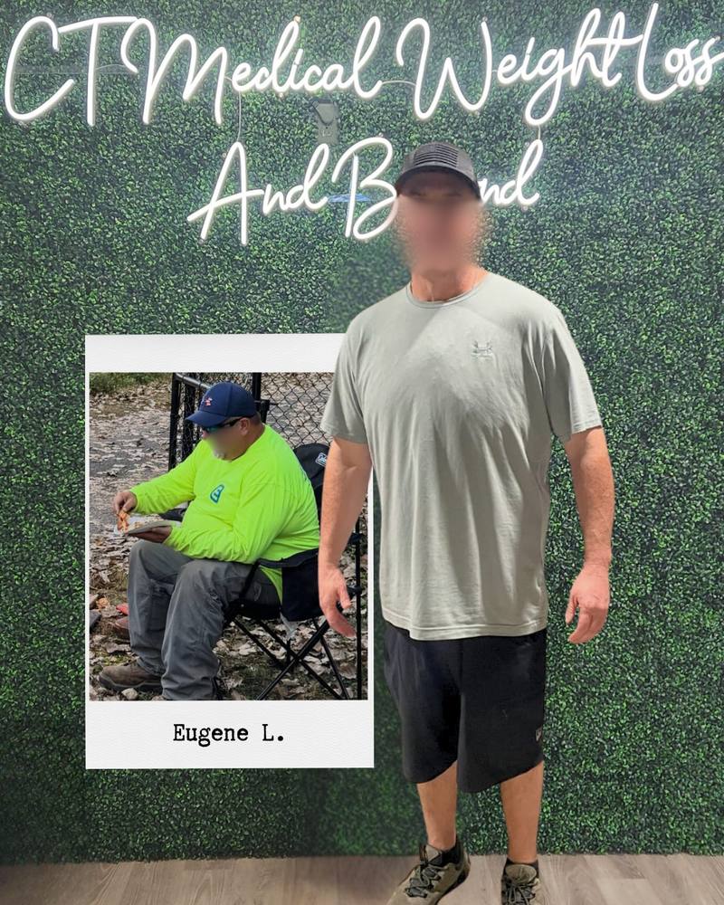 Tirzepatide weight loss results Glastonbury CT — patient down 106 pounds