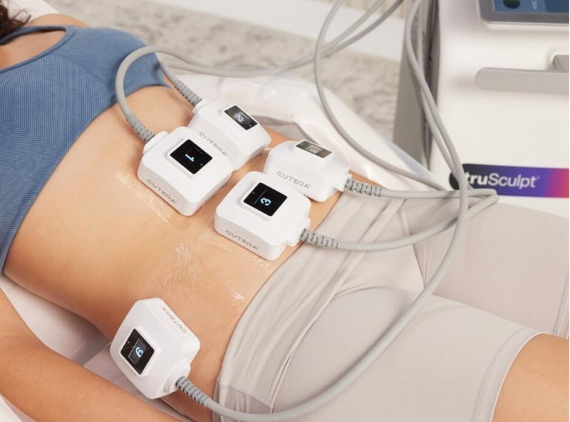 TruSculpt body contouring at CT Medical Weight Loss Glastonbury CT . radiofrequency treatment in progress